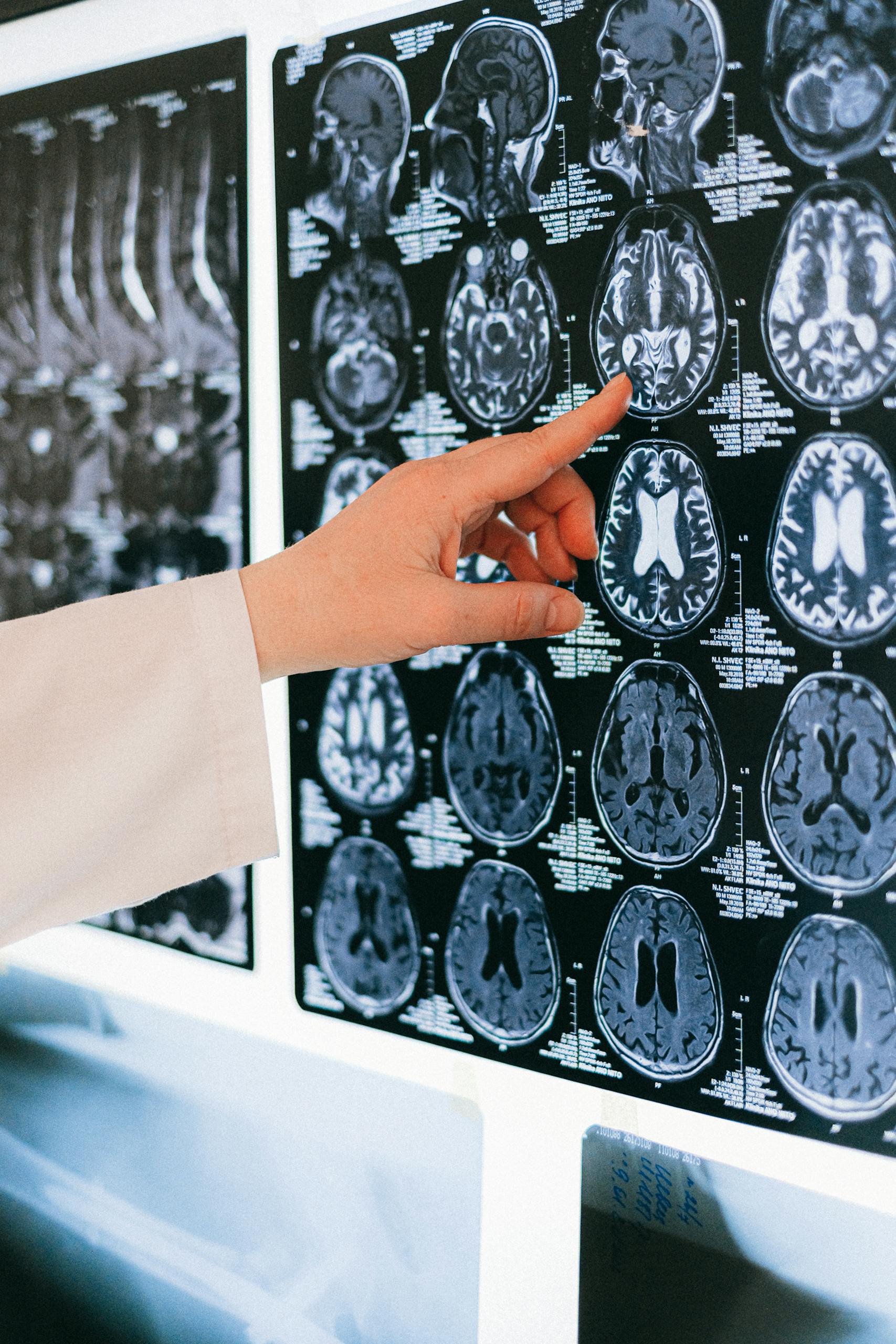 MRI Display